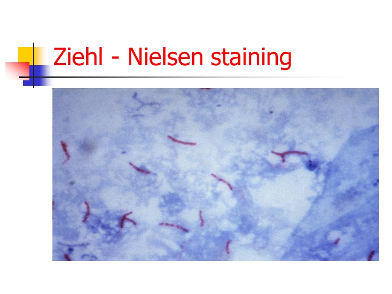 Ziehl - Nielsen staining